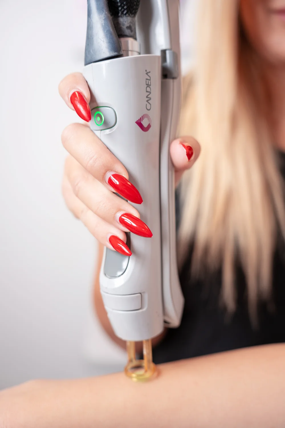 Лазерна епилация с Candela GentleLase Pro